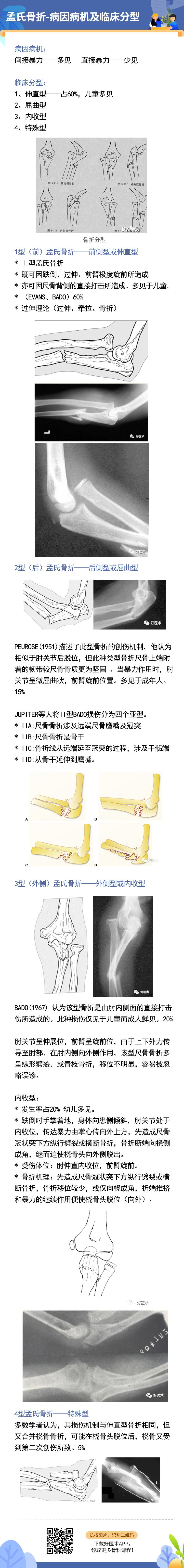 关于孟氏骨折，这篇文章讲得太全面了！