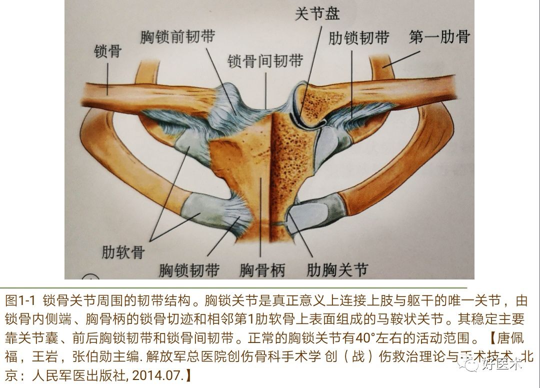 胸锁关节脱位的诊治技巧，系统详解！