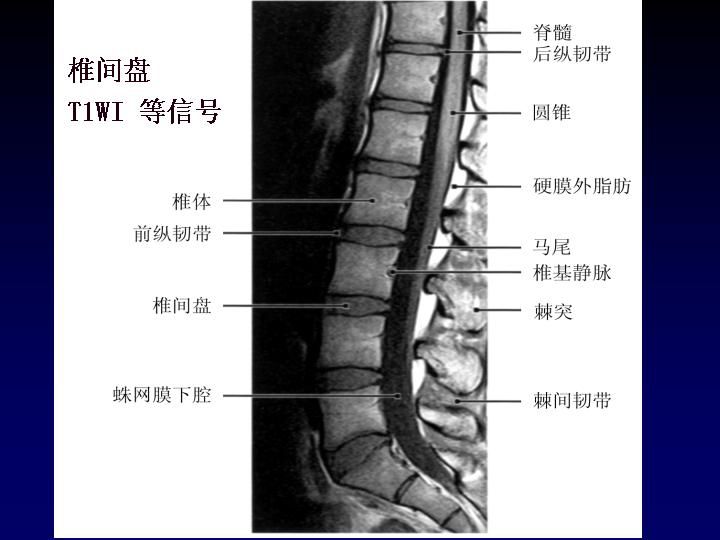 关于腰椎管狭窄症，这篇文章讲得太全面了！