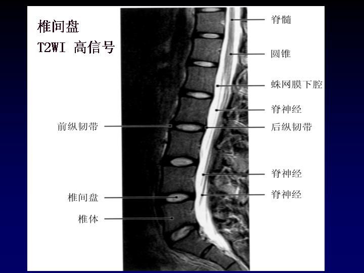 关于腰椎管狭窄症，这篇文章讲得太全面了！