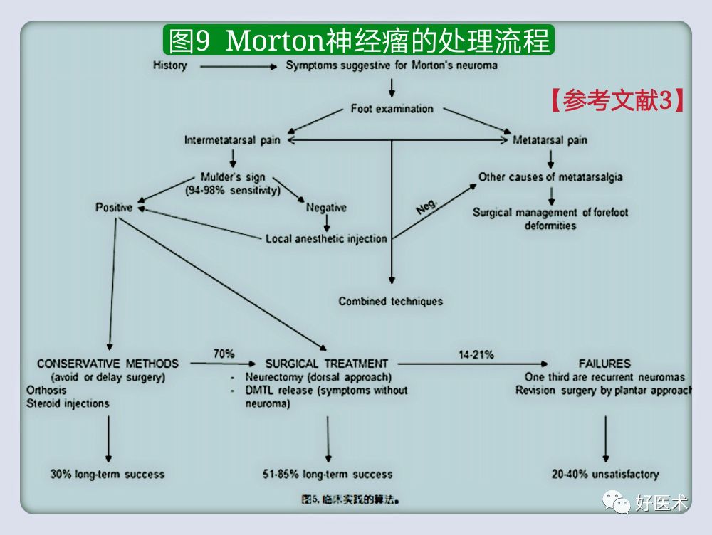 引起前足痛的Morton神经瘤，你了解吗？