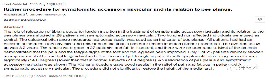 关于平足症的治疗策略，看这篇就够了！