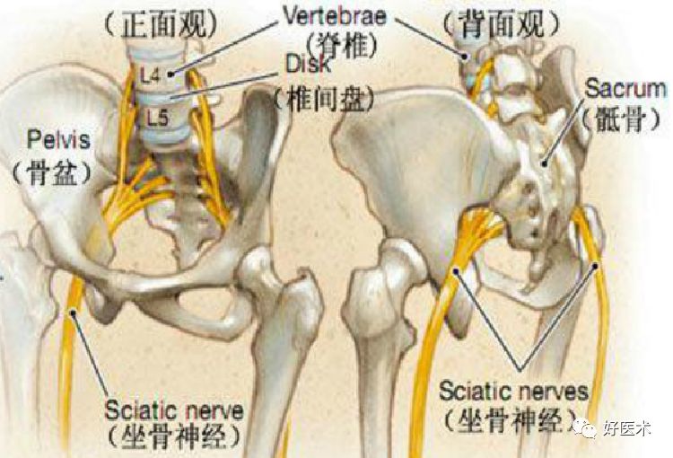 关于梨状肌综合征，你全都了解吗？