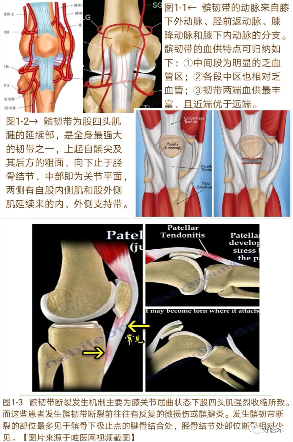 膝关节髌韧带断裂的诊治技巧，系统详解！