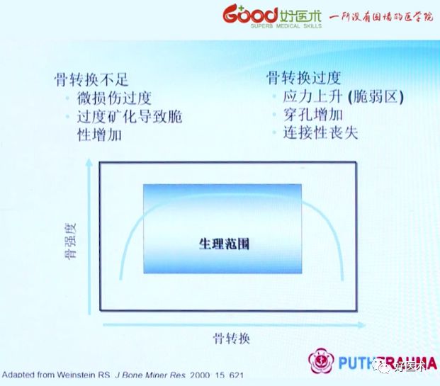 全面讲解！粗隆部骨折的围手术期处理