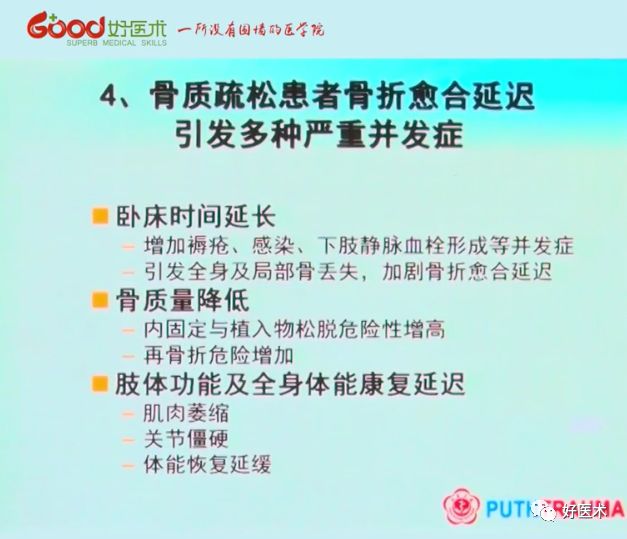 全面讲解！粗隆部骨折的围手术期处理