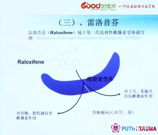 全面讲解！粗隆部骨折的围手术期处理