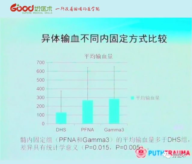 全面讲解！粗隆部骨折的围手术期处理