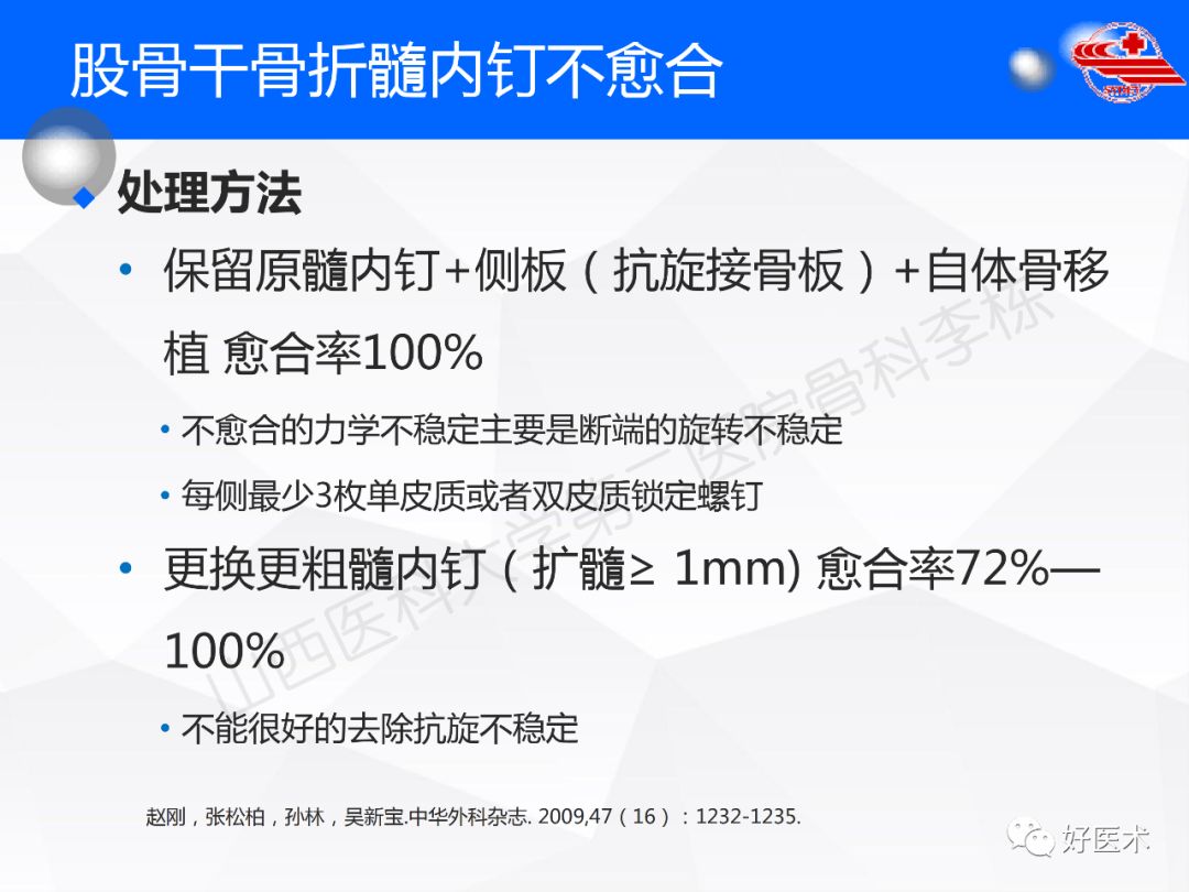 干货收藏帖！股骨干骨折髓内钉固定技巧