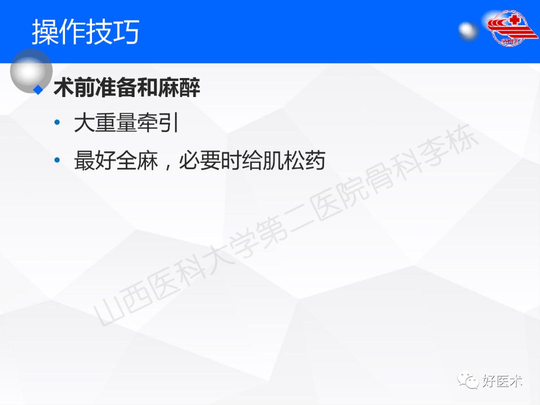 干货收藏帖！股骨干骨折髓内钉固定技巧