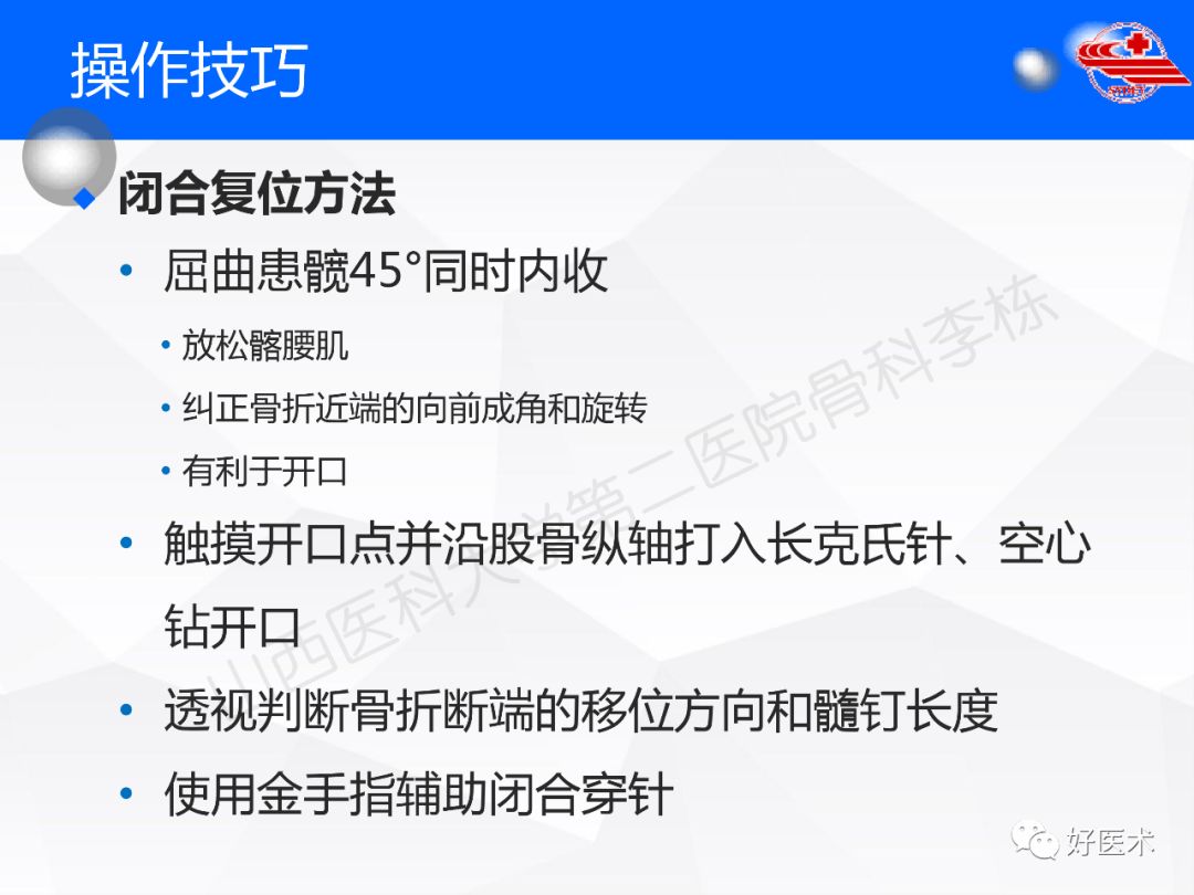 干货收藏帖！股骨干骨折髓内钉固定技巧