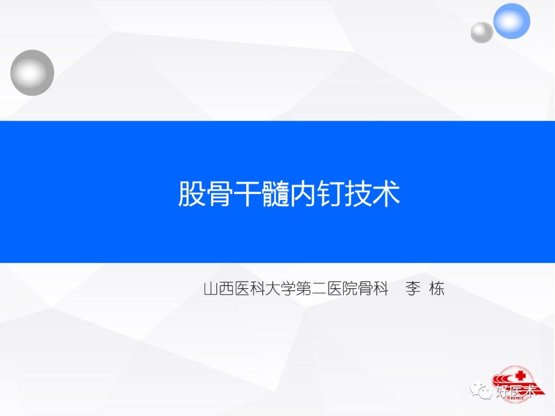 干货收藏帖！股骨干骨折髓内钉固定技巧