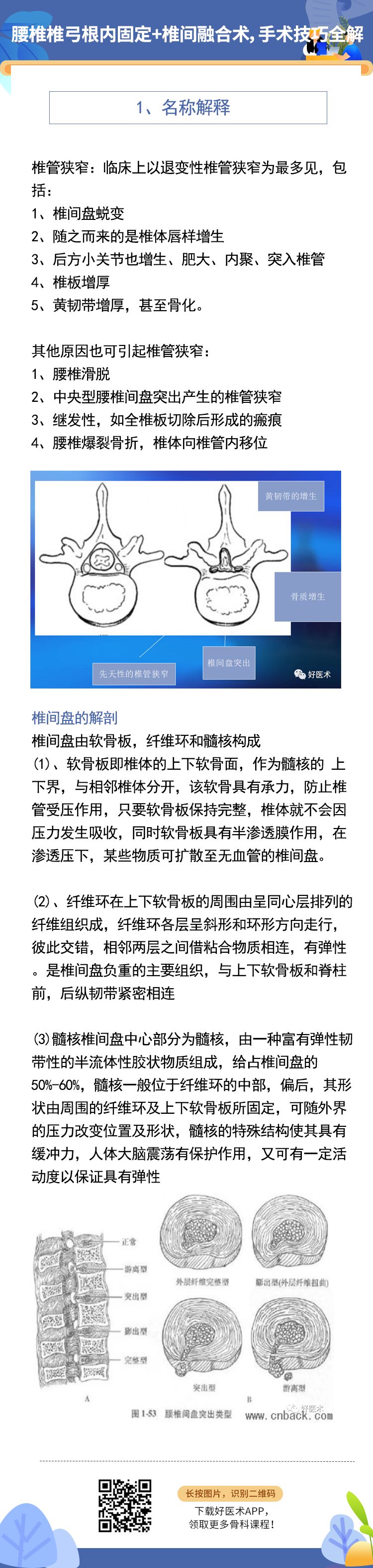 腰椎椎弓根内固定+椎间融合术，手术技巧全解析！