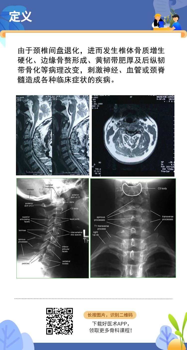 颈椎病知多少？十张图帮你快速复习！
