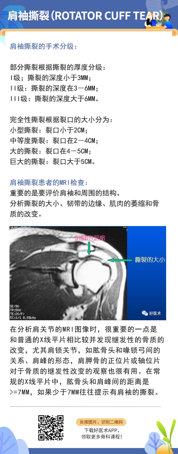 干货来了！一文掌握肩袖损伤MRI诊断技巧