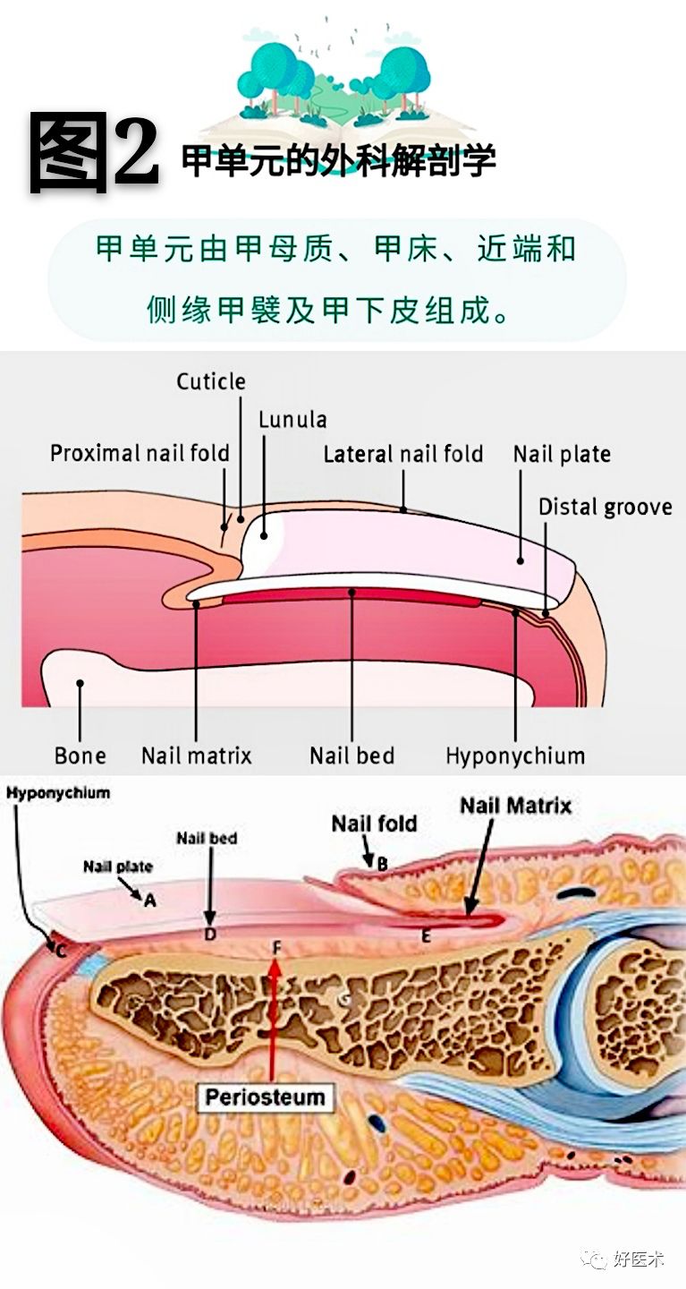 详解治疗嵌甲的7种手术方法，你都掌握了吗？