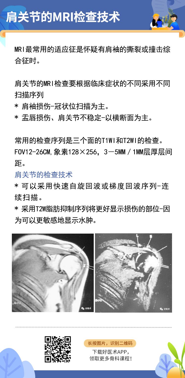 干货来了！一文掌握肩袖损伤MRI诊断技巧