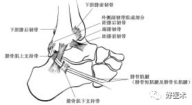 急性踝关节扭伤的诊治要点，看完这篇就够了！