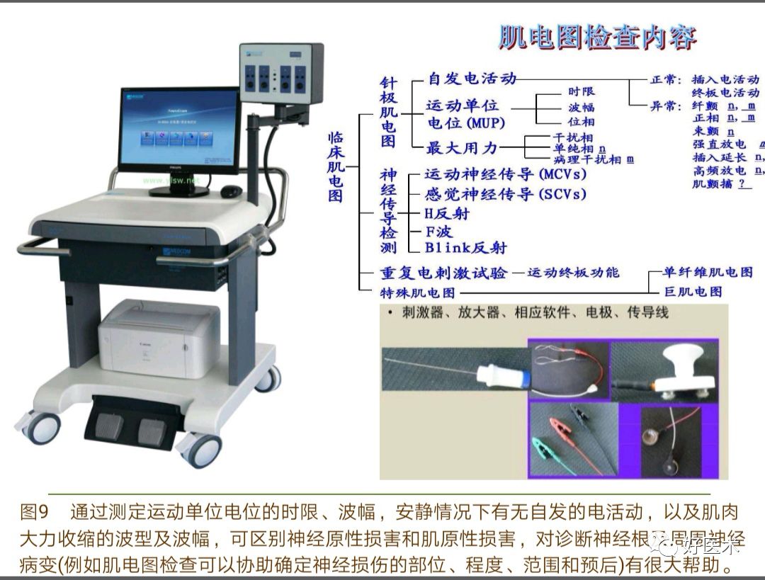 腕尺管综合征的诊治要点，看完这篇就够了！