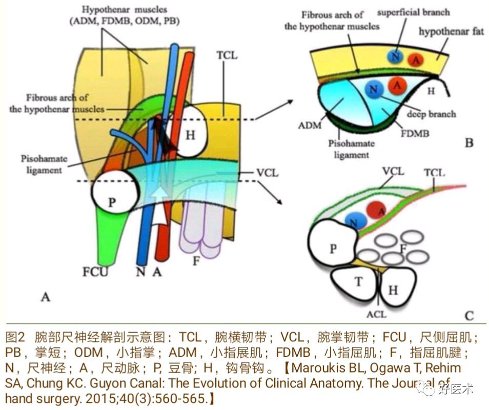 腕尺管综合征的诊治要点，看完这篇就够了！