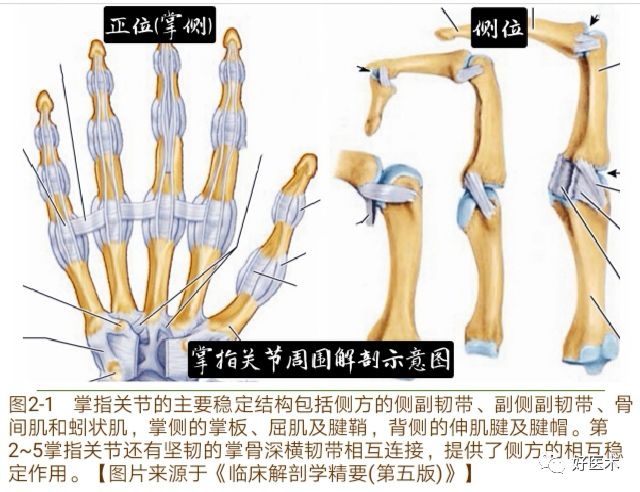 掌指关节脱位的诊治要点，看完这篇就够了！