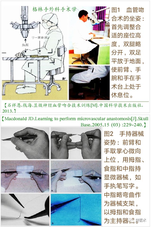 显微血管吻合技术要点详解，值得一看！