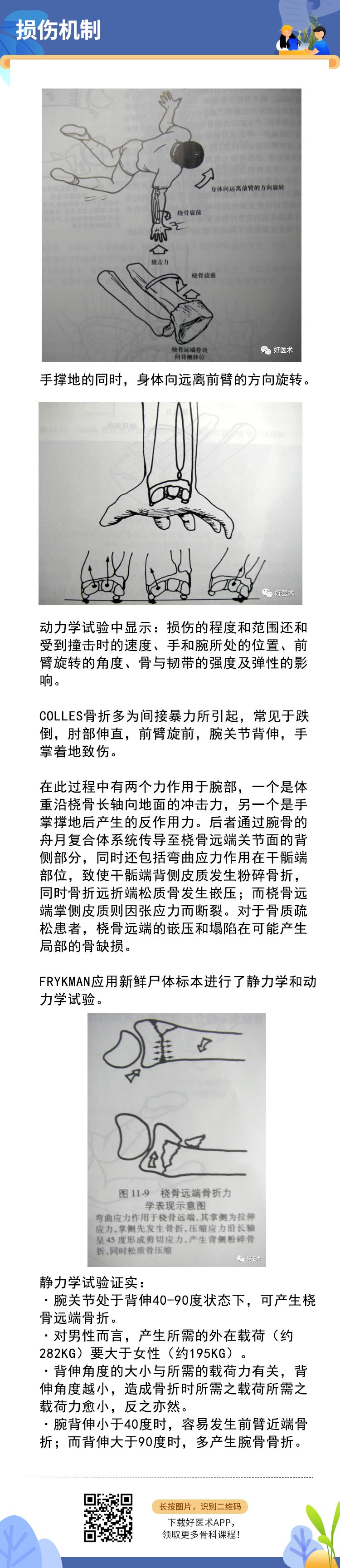 关于Colles骨折，这篇文章讲得太全面了！