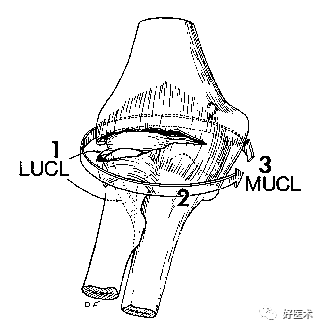 肘关节骨折脱位，我们该如何正确诊治​？