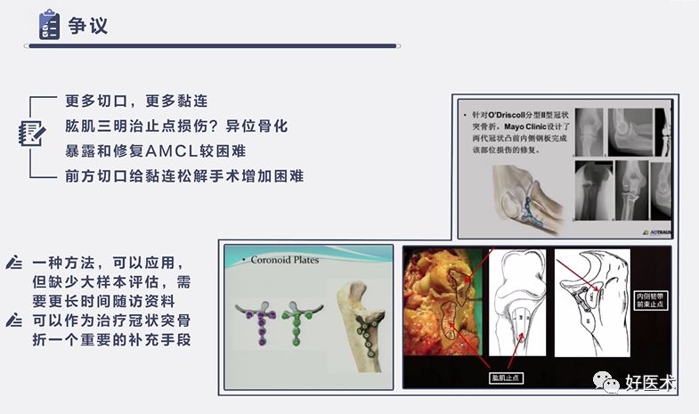 肘关节骨折脱位，我们该如何正确诊治​？