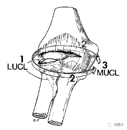 肘关节骨折脱位，我们该如何正确诊治​？