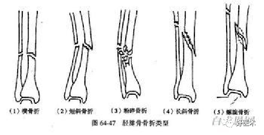 骨科术后体位护理技巧，赶紧收藏备用！