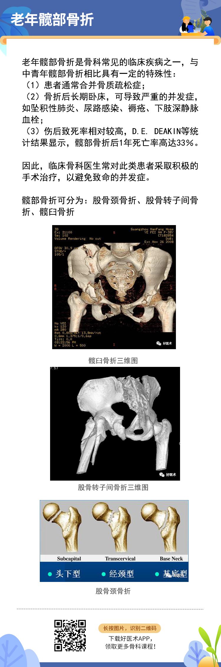 老年髋部骨折后是否手术？这篇给你答案！