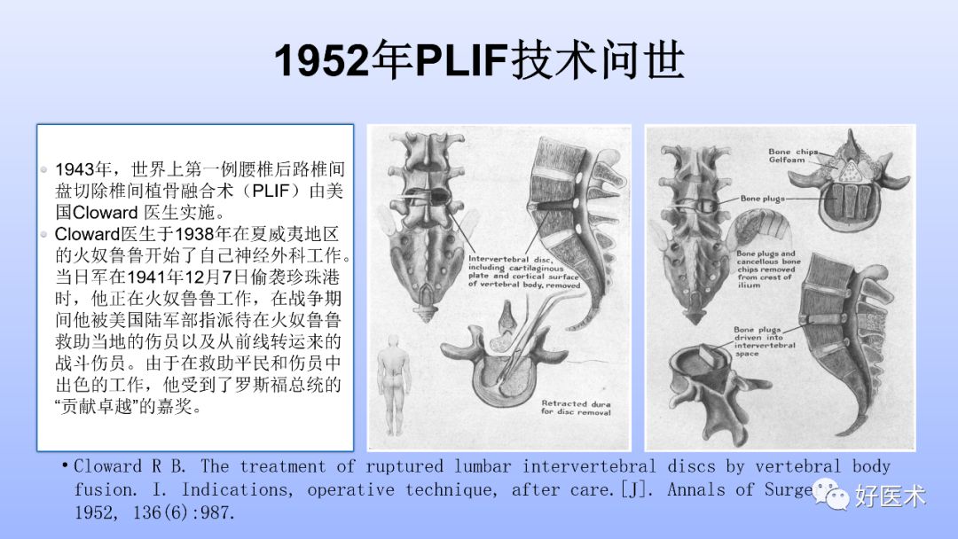 一文带您深度了解：腰椎管狭窄症！