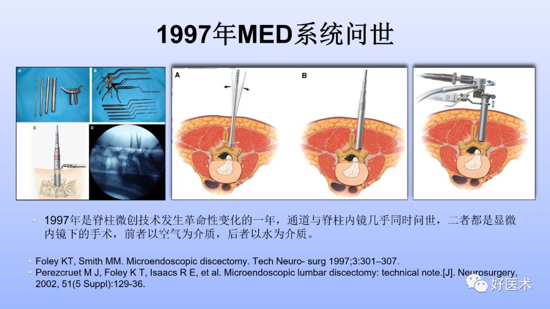 一文带您深度了解：腰椎管狭窄症！