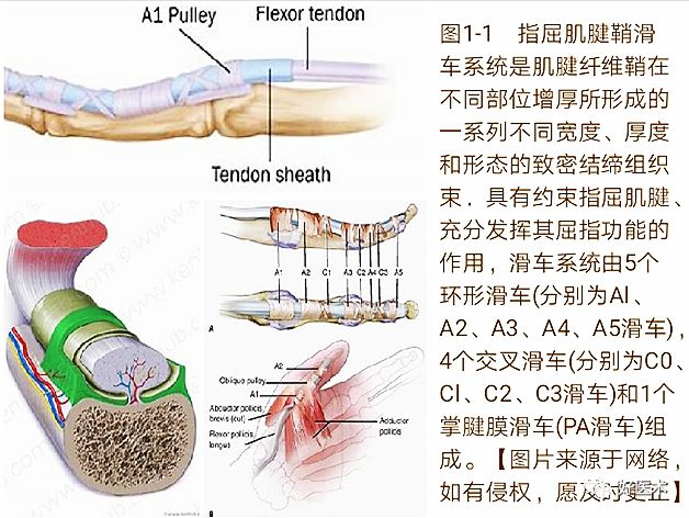 手腕部狭窄性腱鞘炎的诊治，一文掌握！