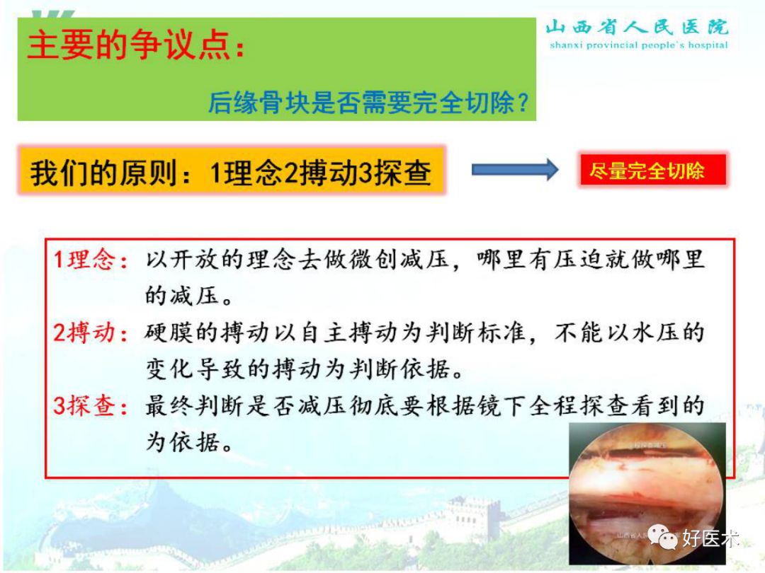 椎间孔镜治疗特殊类型腰椎间盘突出症，要点详解！