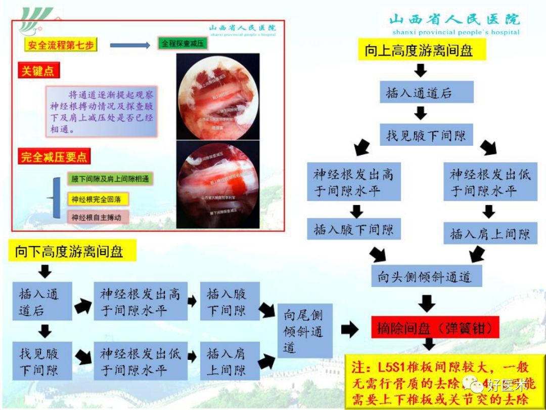 椎间孔镜治疗特殊类型腰椎间盘突出症，要点详解！