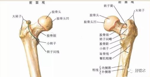 转子间骨折外侧壁不完整，如何处理？