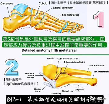 关于第五跖骨基底部骨折，你都掌握了吗？