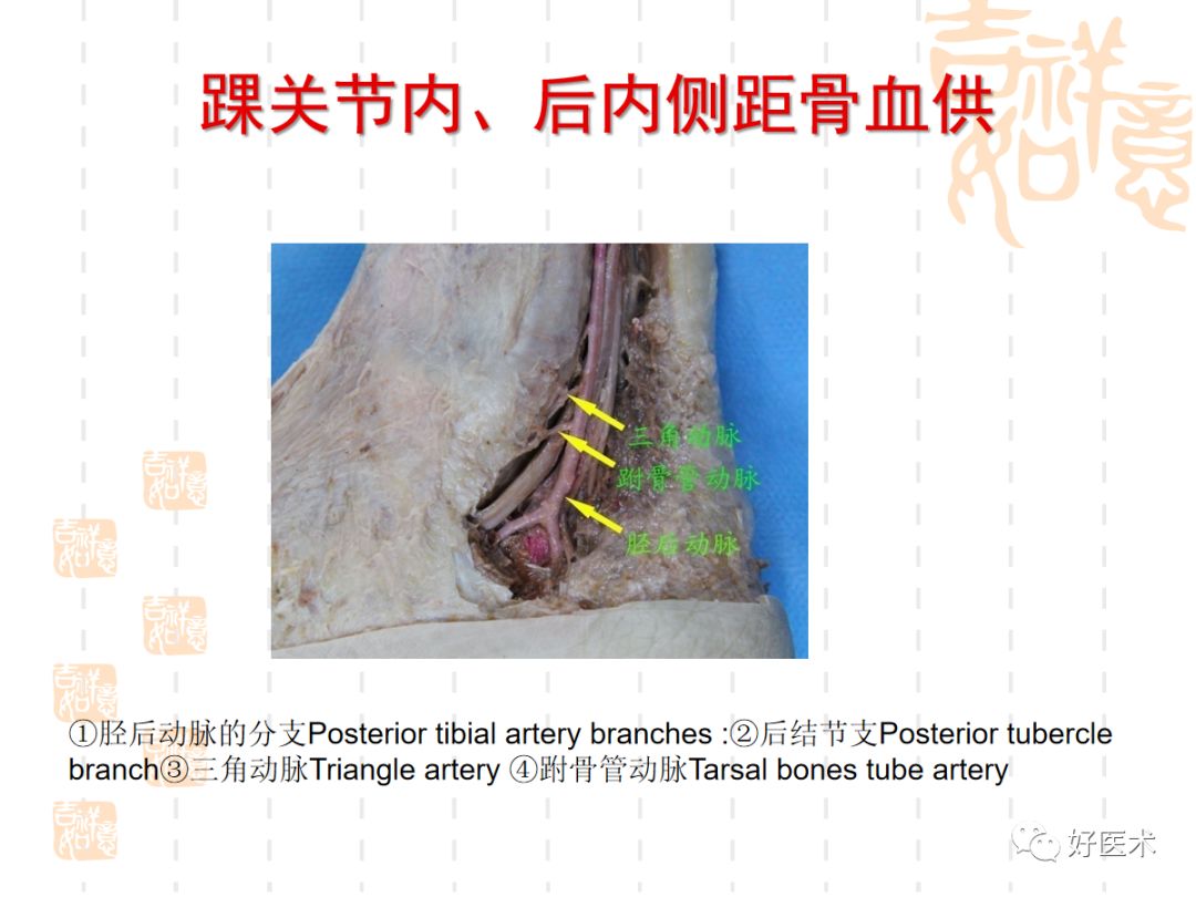 距骨骨折的手术入路及治疗技巧详解，值得一看！