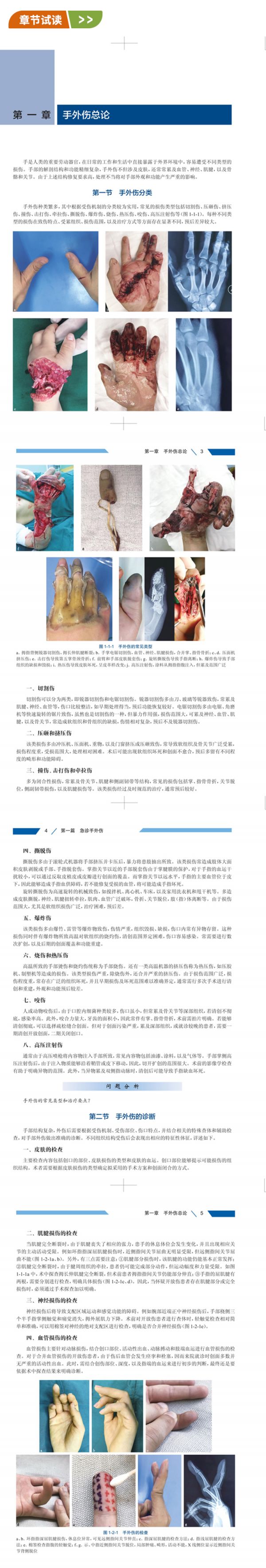 新书推荐：手外科治疗技术有疑惑？你需要这本书！