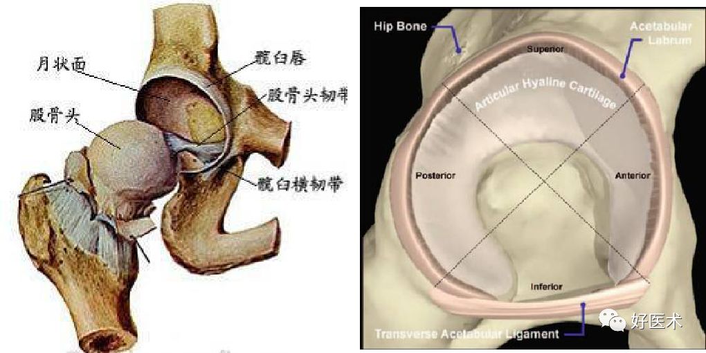 什么是“髋关节撞击综合征”？本文告诉你！