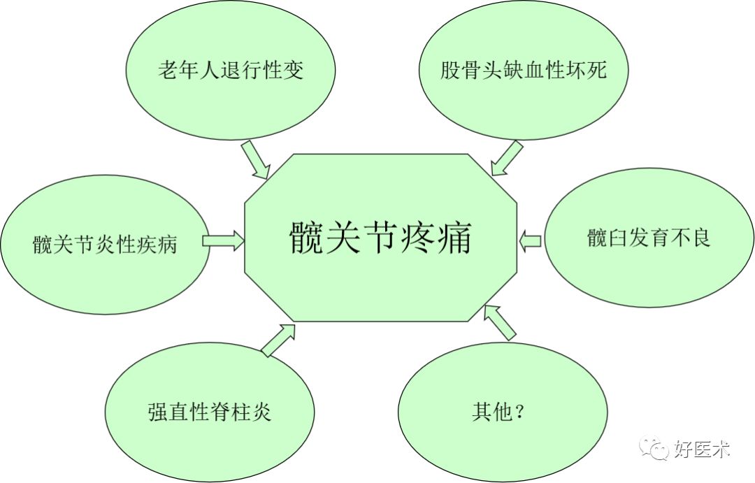 什么是“髋关节撞击综合征”？本文告诉你！