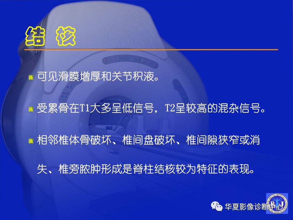 关于骨关节炎，这篇文章讲的太全了！