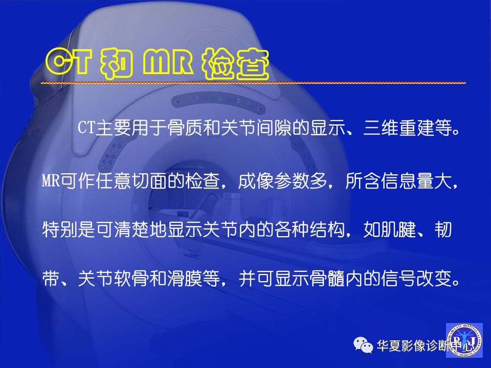 关于骨关节炎，这篇文章讲的太全了！