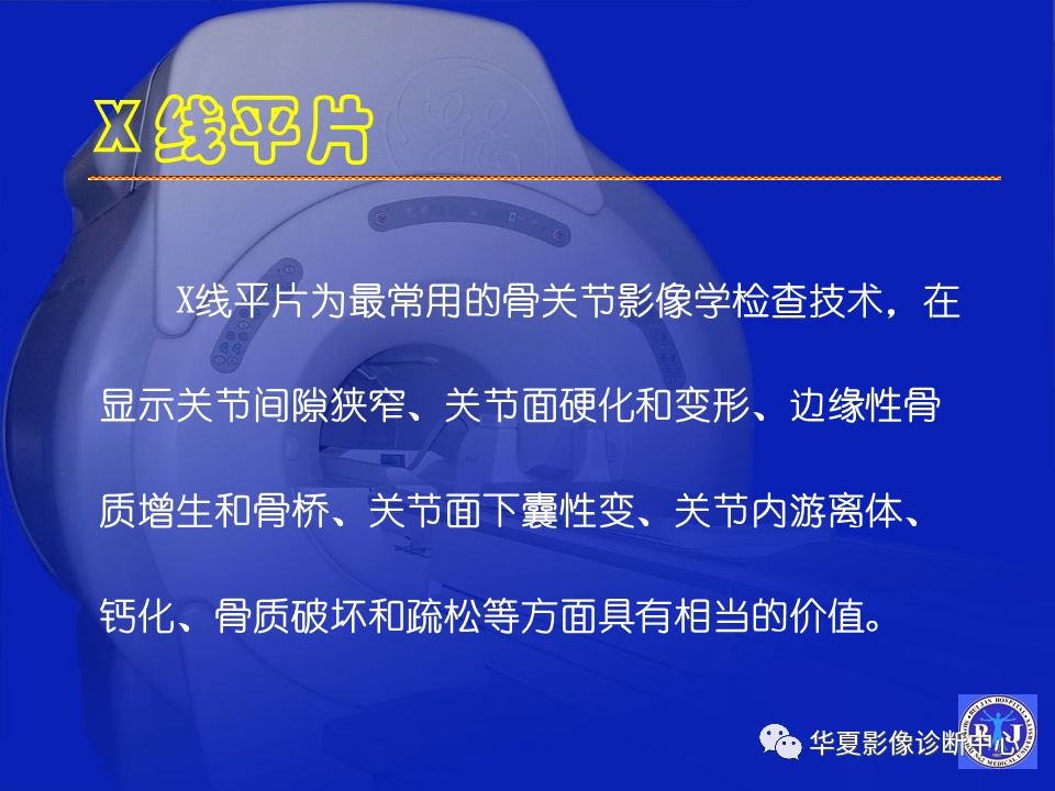 关于骨关节炎，这篇文章讲的太全了！