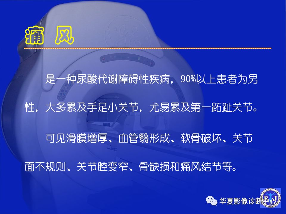 关于骨关节炎，这篇文章讲的太全了！