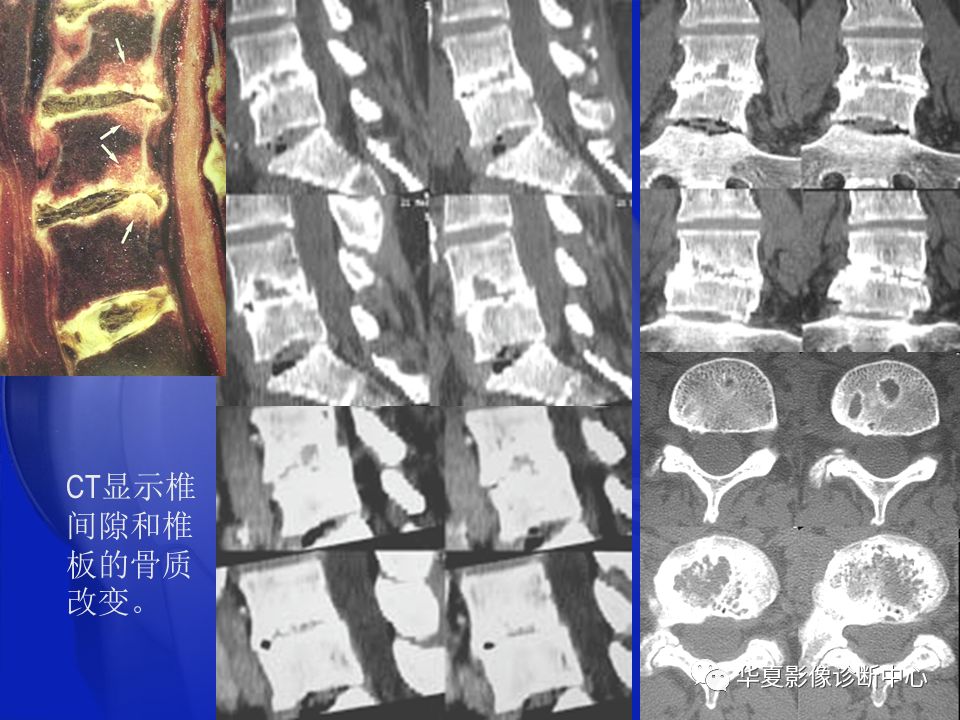 关于骨关节炎，这篇文章讲的太全了！