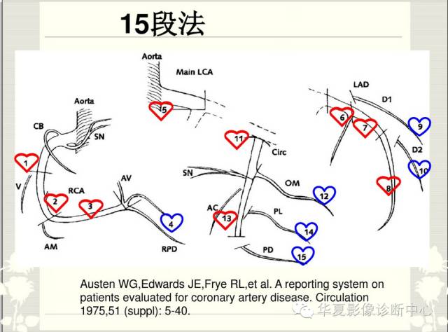 图文详解冠脉解剖及分段，值得收藏！