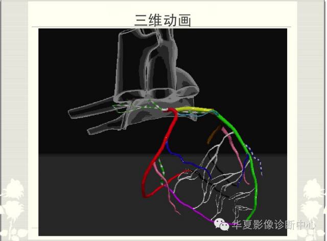 图文详解冠脉解剖及分段，值得收藏！